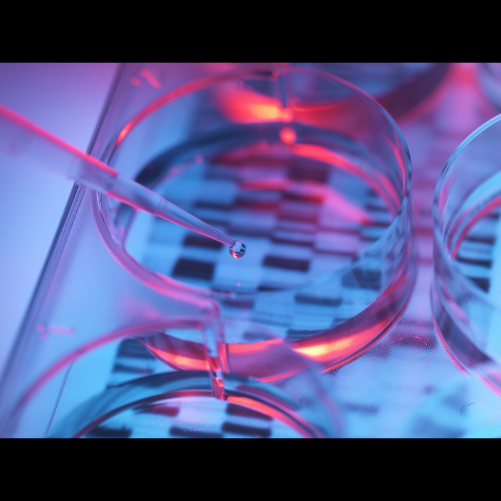 [0556-MBC021-R] Amplirun® Haemophilus Ducreyi DNA Control size: 10,000size:20,000 c/µL